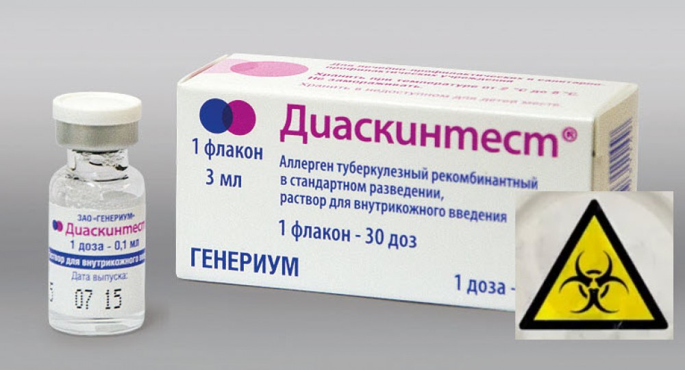 Диаскинтест - генно-инженерный продукт вместо Манту